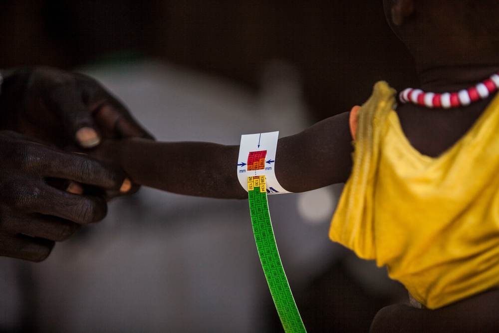 Malaria and malnutrition in South Sudan, Bentiu PoC