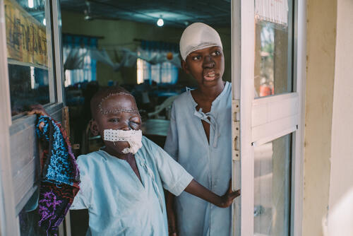  Umar and Adamu - Noma Survivors at the MSF's noma hospital in Sokoto, Nigeria.