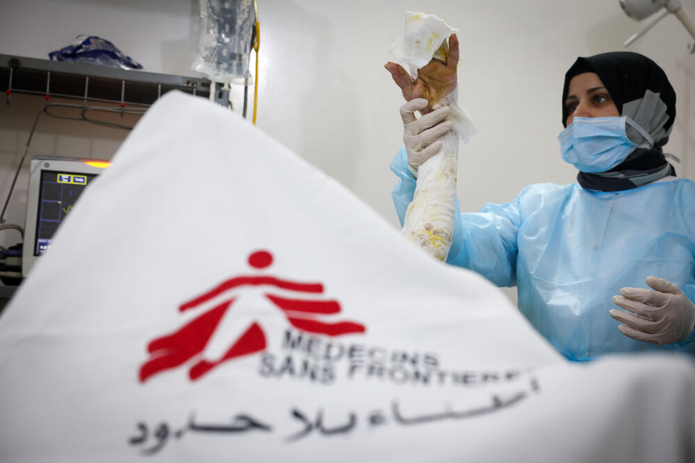 A member of the MSF surgical team examines a patient in the operating theatre of the MSF burns unit at Atmeh Hospital