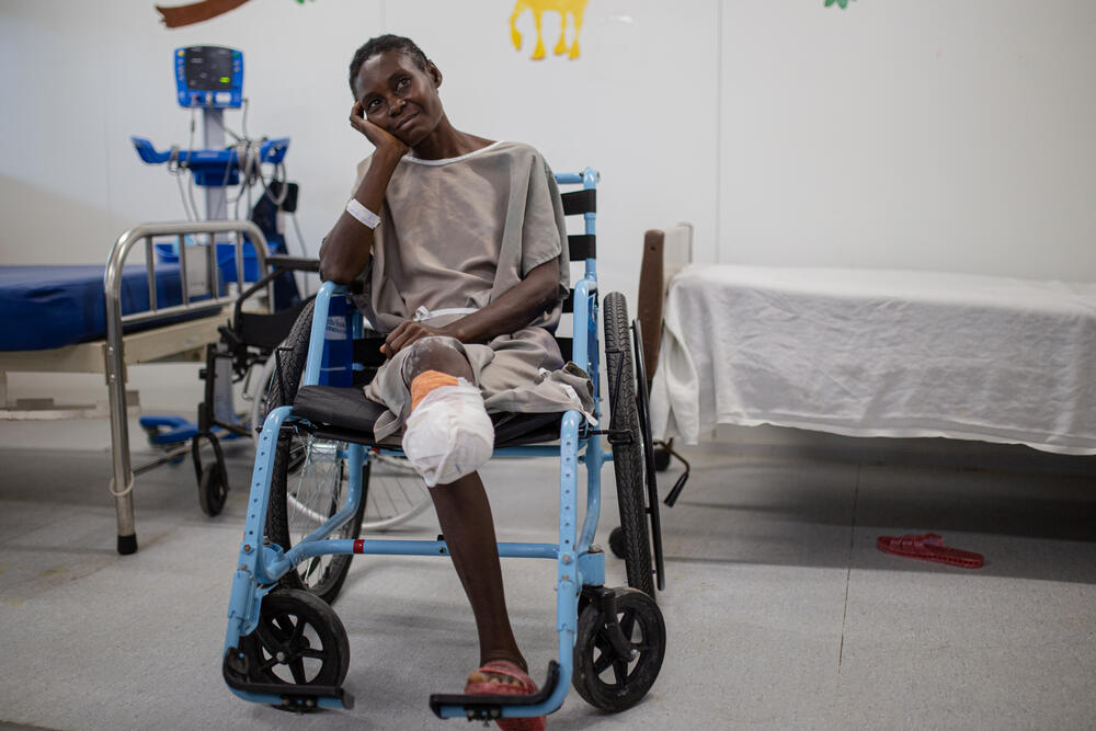 MSF patient Claudette who was hit by a stay bullet close to her home and had to have her leg amputated