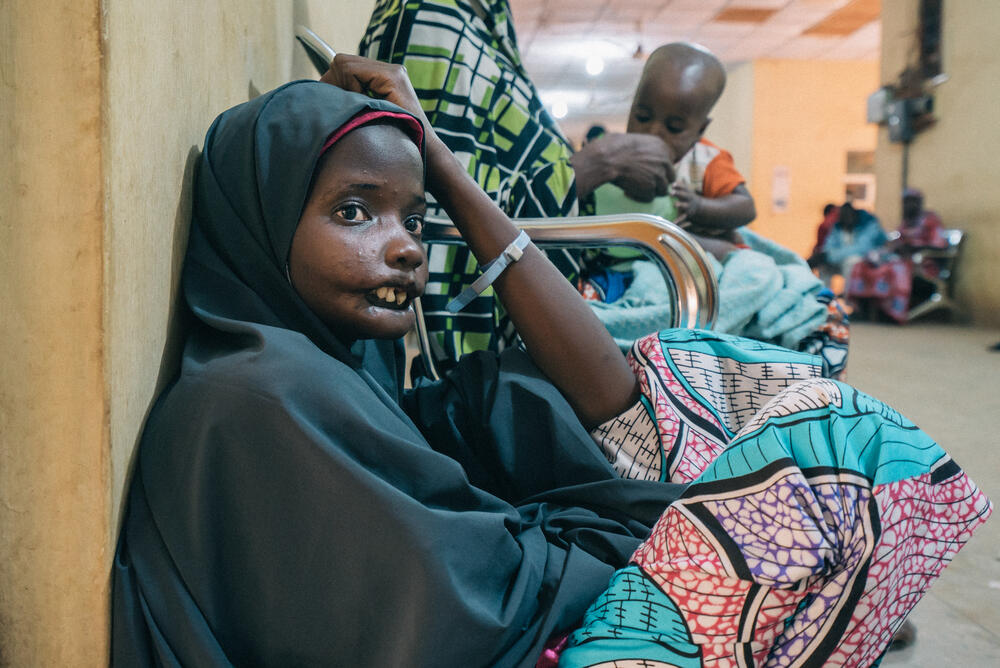 Amina, an 18-year-old noma patient, waiting in the MSF-supported Sokoto hospital