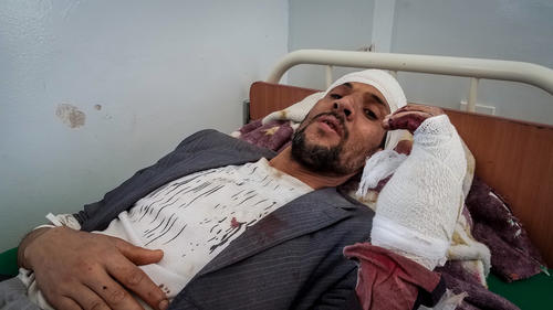 Victims of airstrike in Sanaa Victims of airstrike in Sanaa