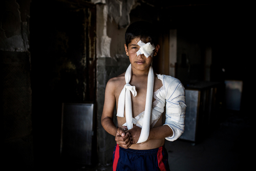 Post Operative Care in South Mosul, Iraq Post Operative Care in South Mosul, Iraq