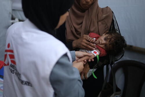 Malnutrition Continues to Escalate in Gaza Malnutrition Continues to Escalate in Gaza