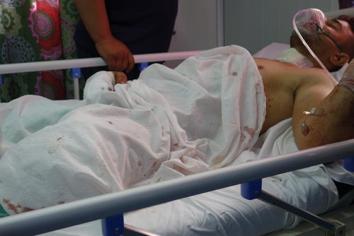 Influx of patiens in Qayara hospital Influx of patiens in Qayara hospital
