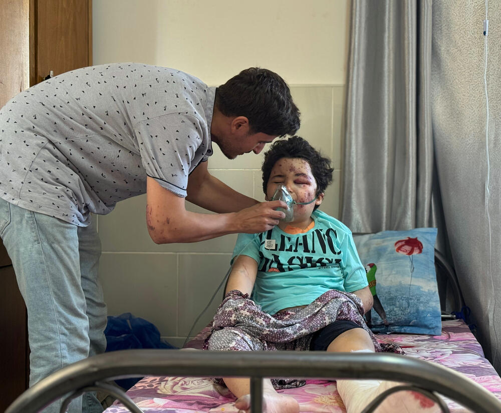 8-year old Kareem wears an oxygen mask in Al-Shifa hospital after being injured in an airstrike on his home in Gaza city.