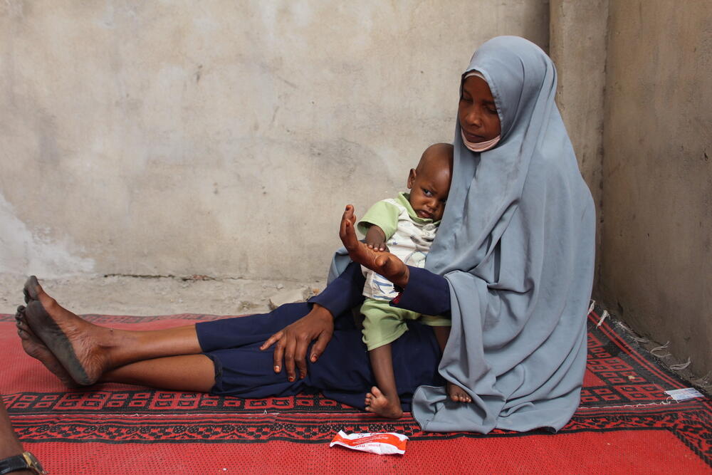 Achta Abakar waits with her 13-month-old baby boy at an MSF therapeutic feeding centre in Chad