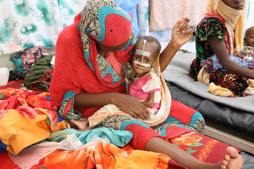 MSF IN CHAD: TACKLING MALNUTRITION IN AM TIMAN MSF IN CHAD: TACKLING MALNUTRITION IN AM TIMAN