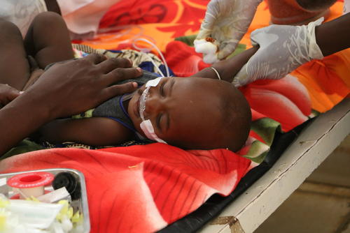 MSF IN CHAD: TACKLING MALNUTRITION IN AM TIMAN MSF IN CHAD: TACKLING MALNUTRITION IN AM TIMAN