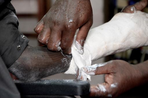 Physiotherapy at SICA hospital, Bangui Physiotherapy at SICA hospital, Bangui