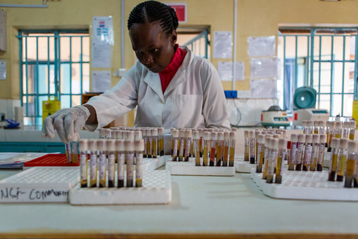 Advanced HIV management in Homa Bay Advanced HIV management in Homa Bay