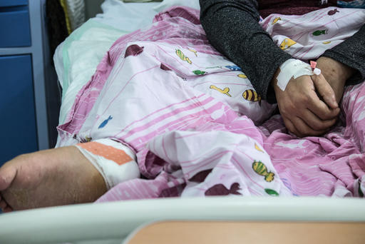 Zainab - war wounded - Mosul Zainab - war wounded - Mosul