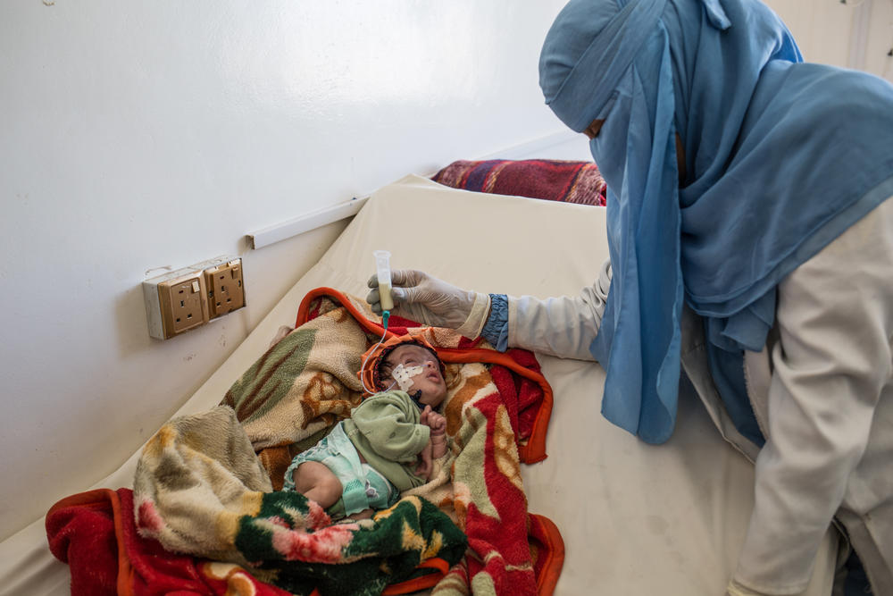 A mother with her severely malnourished child in Yemen.