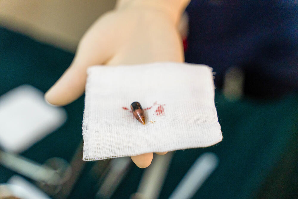 A bullet extracted from a patient by the surgical team at Bashair Hospital. Bullet wounds are the most common treated by the team.