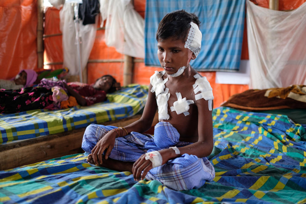 An injured Rohingya boy sits on his bed at MSF's medical facility in Kutupalong.