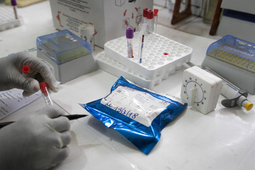 Treating HIV and AIDS in Conakry Treating HIV and AIDS in Conakry