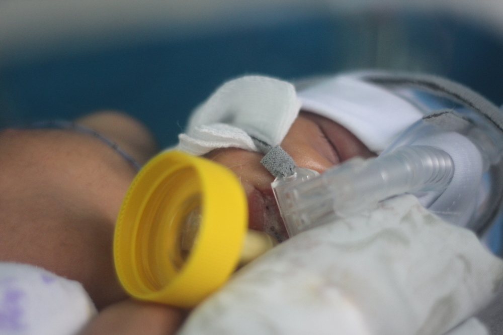 A newborn Syrian baby in the neo-natal care unit of the MSF Mother and Child Hospital in Irbid, Jordan.