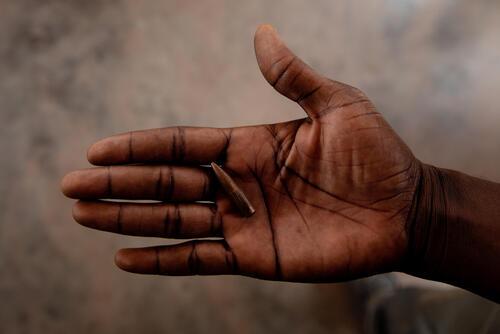 The journey of a wounded woman at MSF'SICA hospital in Bangui