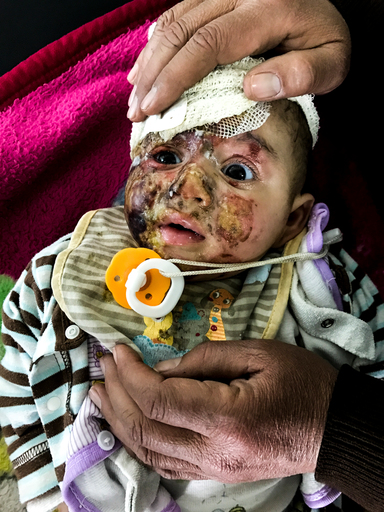 Mosul : Qayyarah hospital Mosul : Qayyarah hospital