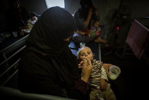 Qayyarah : Babies suffering from malnutrition Qayyarah : Babies suffering from malnutrition