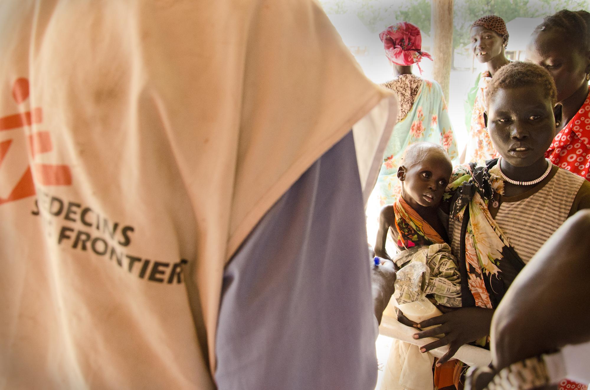 Child malnutrition rates skyrocket in South Sudan | MSF