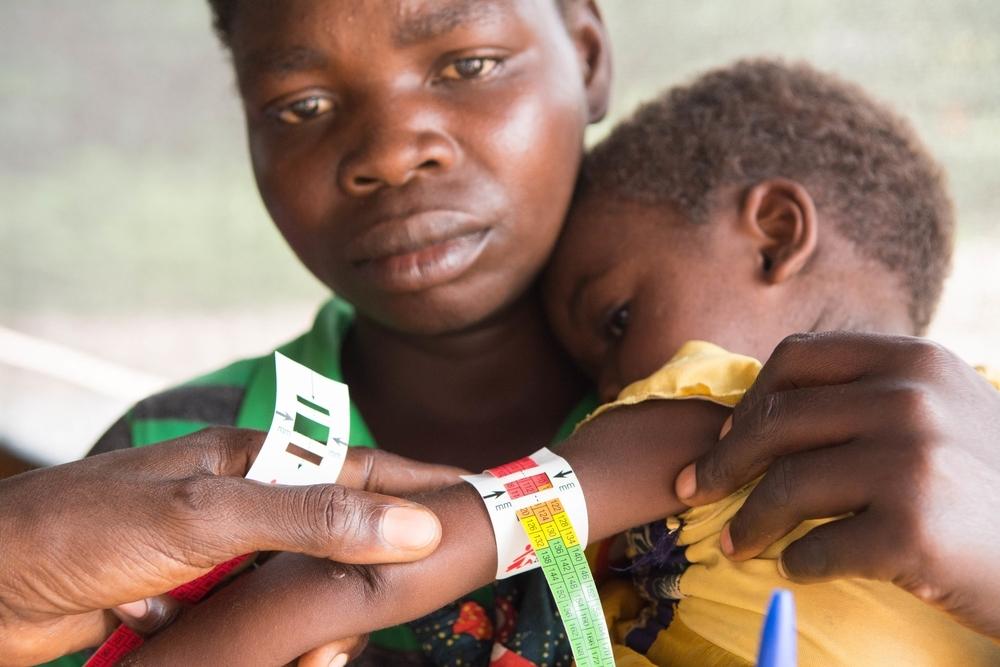 A child is assessed for malnutrition in Manono health zone, Democratic Republic of Congo.