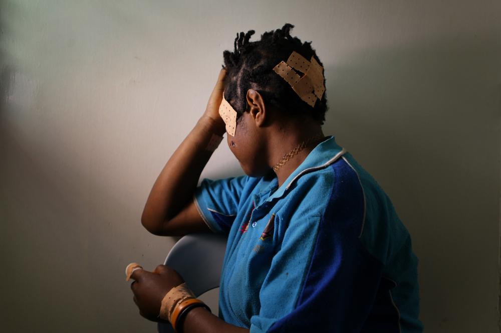 A 22-year-old patient at MSF's Family Support Centre in Tari, PNG. She was attacked by her husband, who punched and cut her with a bush knife. 
