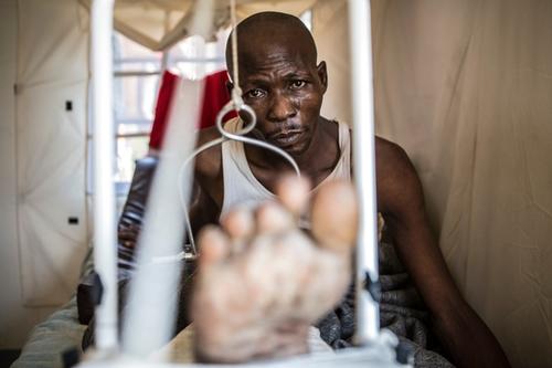 CAR wounded in Hopital Communautaire, Bangui CAR wounded in Hopital Communautaire, Bangui