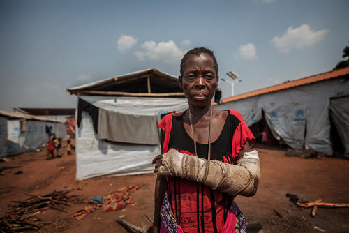 A refugee who fled Kasai in the Cacanda camp, Angola, July 2017.
