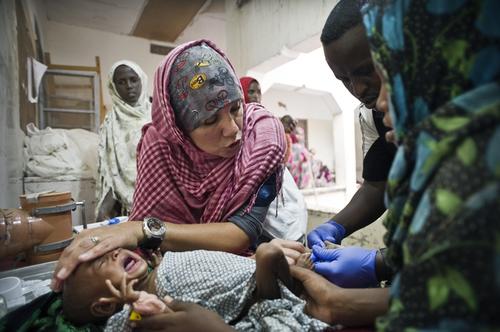 Somalia: A severely malnourished child is given an intravenous line. Somalia: A severely malnourished child is given an intravenous line.
