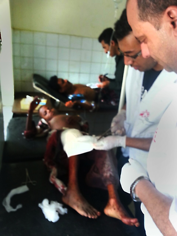 Lékaři bez hranic ošetřují oběť leteckého útoku na uprchlický tábor Al Mazraq v Jemenu.