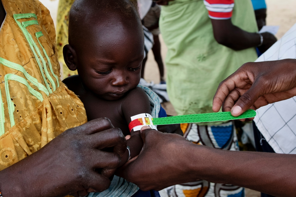 A MUAC (middle upper arm circumference) bracelet is used to check a child for malnutrition, Zinder region.